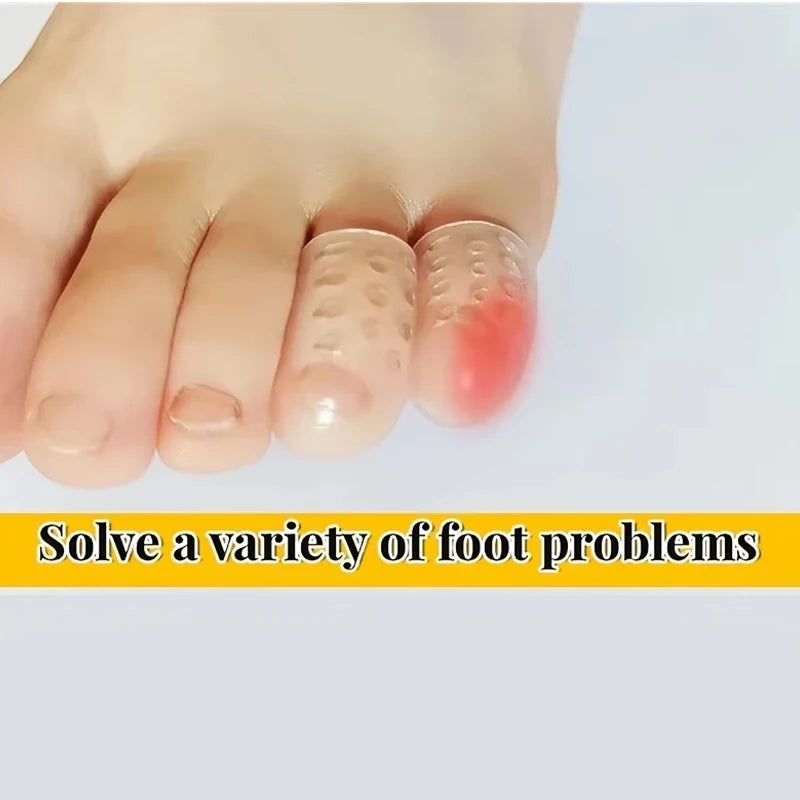 Silicone Finger & Toe Cap Protectors — Soft Sleeve Covers for Corns, Blisters & Bunion Pain Relief
